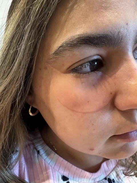 noticed dark circles brightened and under-eye skin looked...