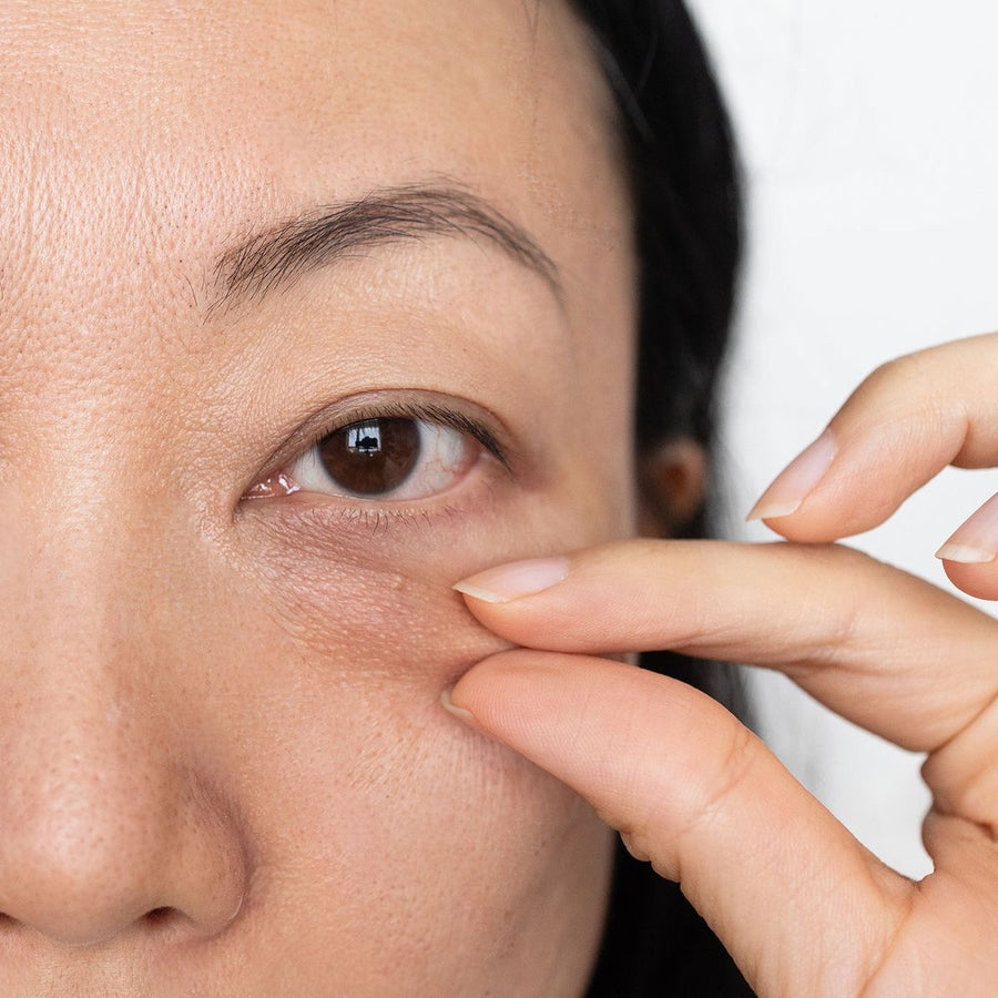 Why Your Under-Eyes Look Tired No Matter How Much You Sleep